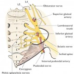 Sciatica